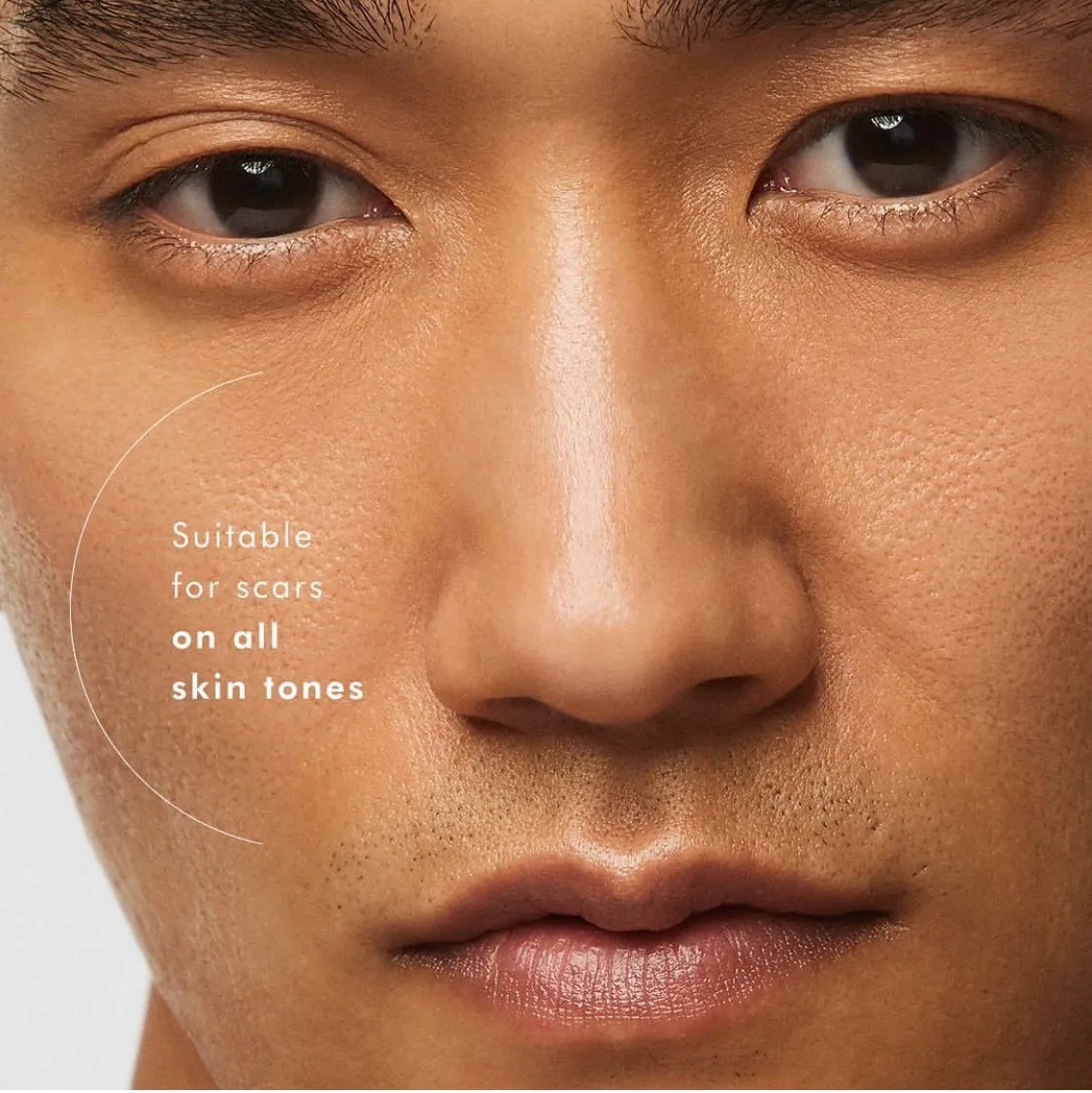 SkinCeuticals Advanced Scar Control